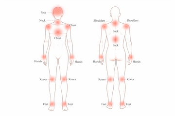 Educational diagram showing recommended red light therapy body placement areas.